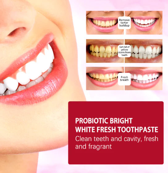 SP-4 Teeth Whitening Toothpaste (120g)