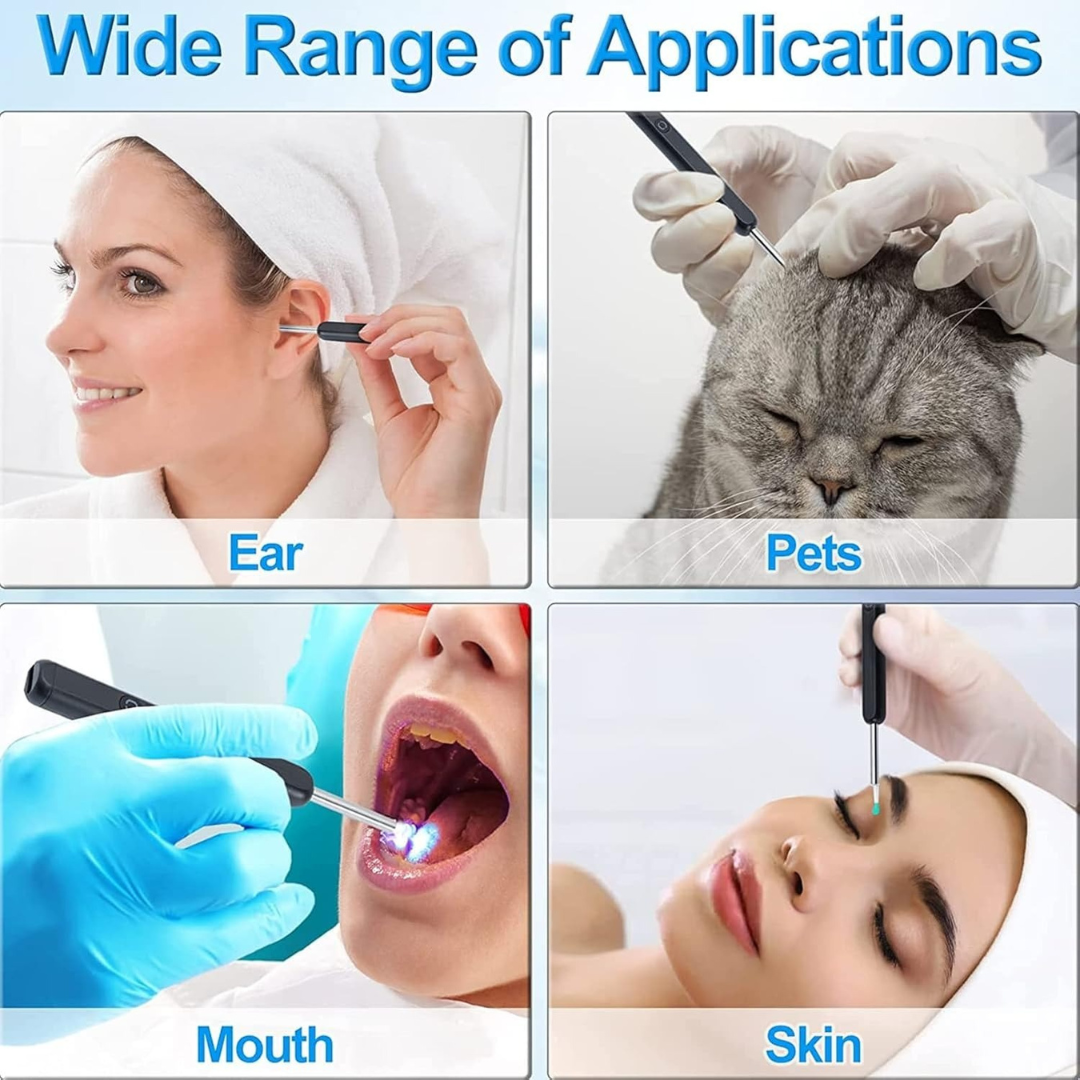 Smart Ear Wax Cleaning Kit – Safe for All Ages