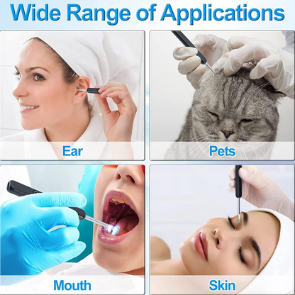 Smart Ear Wax Cleaning Kit – Safe for All Ages